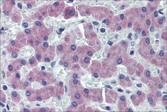 Anti-SLC27A2 antibody produced in rabbit affinity isolated antibody