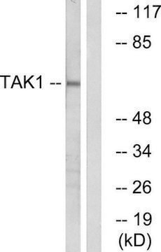 Anti-TAK1 antibody produced in rabbit affinity isolated antibody