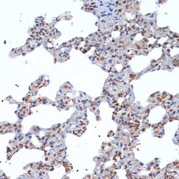 Anti-SOCS2 antibody produced in rabbit