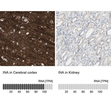 Anti-INA antibody produced in rabbit Prestige Antibodies&#174; Powered by Atlas Antibodies, affinity isolated antibody, buffered aqueous glycerol solution