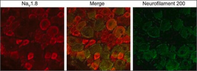 Anti-Sodium Channel NaV1.8 antibody produced in rabbit affinity isolated antibody, lyophilized powder