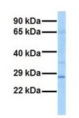 Anti-GSTM1 antibody produced in rabbit affinity isolated antibody