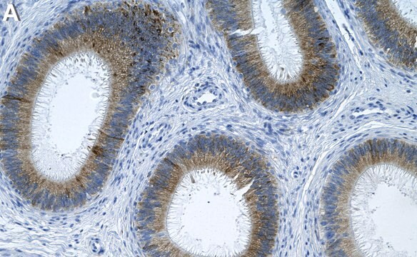 Anti-ECM1 Antibody, clone 1C6 ZooMAb&#174; Rabbit Monoclonal recombinant, expressed in HEK 293 cells