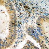 Anti-phospho-HDAC8 (pSer39) antibody produced in rabbit affinity isolated antibody
