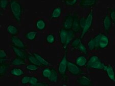 Anti-Histone Deacetylase 10 (HDAC10) antibody produced in rabbit affinity isolated antibody, buffered aqueous solution