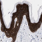 Anti-TRIM29 antibody produced in rabbit Prestige Antibodies&#174; Powered by Atlas Antibodies, affinity isolated antibody, buffered aqueous glycerol solution