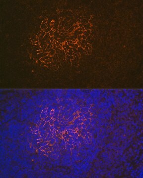 Anti-CR2/CD21 Antibody, clone 9F8A1, Rabbit Monoclonal