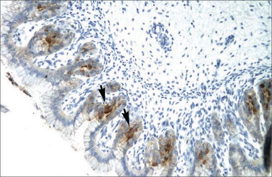 Anti-ETV6 antibody produced in rabbit affinity isolated antibody