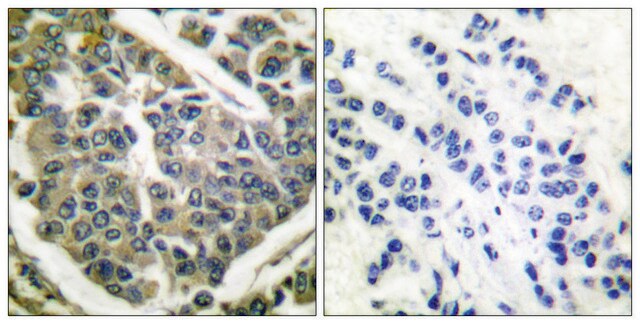 Anti-Collagen IV antibody produced in rabbit affinity isolated antibody