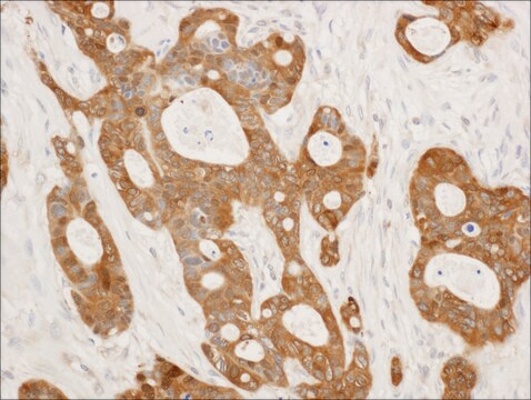 Rabbit anti-14-3-3 Sigma Antibody, Affinity Purified Powered by Bethyl Laboratories, Inc.