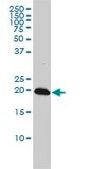 Monoclonal Anti-C22orf18 antibody produced in mouse clone 4C12-2C8, purified immunoglobulin, buffered aqueous solution