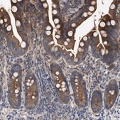 Anti-CDKN2C antibody produced in rabbit Prestige Antibodies&#174; Powered by Atlas Antibodies, affinity isolated antibody, buffered aqueous glycerol solution