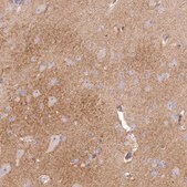 Anti-SLC6A11 antibody produced in rabbit Prestige Antibodies&#174; Powered by Atlas Antibodies, affinity isolated antibody, buffered aqueous glycerol solution