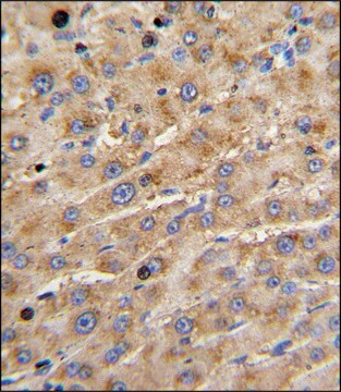 ANTI-ADAMTS13 (CENTER) antibody produced in rabbit IgG fraction of antiserum, buffered aqueous solution