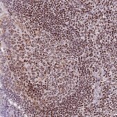 Anti-HDAC8 antibody produced in rabbit Prestige Antibodies&#174; Powered by Atlas Antibodies, affinity isolated antibody, buffered aqueous glycerol solution