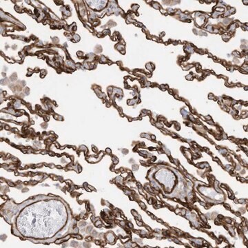 Anti-ABCB7 antibody produced in rabbit Prestige Antibodies&#174; Powered by Atlas Antibodies, affinity isolated antibody, buffered aqueous glycerol solution