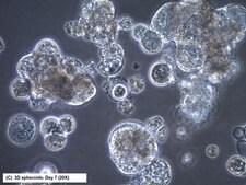 Linia komórkowa CR4 ludzkiego raka jelita grubego CR4 is a unique, cancer stem cell (CSC) enriched, human colorectal cancer cell line useful for CSC-targeted drug development and research focused on cancer cell and CSC biology.