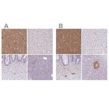 Anti-TPPP antibody produced in rabbit Prestige Antibodies&#174; Powered by Atlas Antibodies, affinity isolated antibody, buffered aqueous glycerol solution