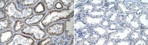 Anti-TRPV1 Antibody, clone 1N19 ZooMAb&#174; Rabbit Monoclonal recombinant, expressed in HEK 293 cells