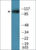 Anti-phospho-PKD1/PKC mu (pTyr463) antibody produced in rabbit affinity isolated antibody
