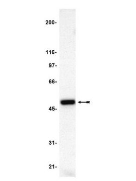 Anti-p47-phox Antibody serum, Upstate&#174;