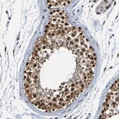 Anti-HDAC2 antibody produced in rabbit affinity isolated antibody, buffered aqueous glycerol solution