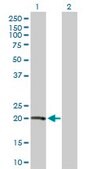 Anti-VHL antibody produced in mouse purified immunoglobulin, buffered aqueous solution