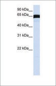 Anti-PLK1 affinity isolated antibody