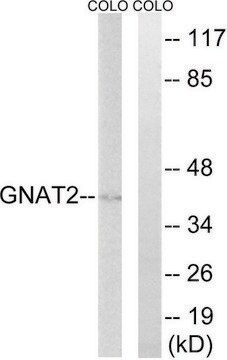 Anti-GNAT2 antibody produced in rabbit affinity isolated antibody