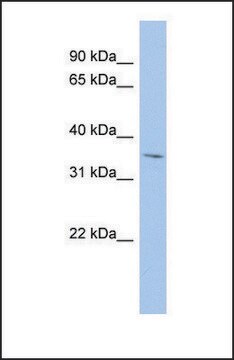 Anti-MPST antibody produced in rabbit affinity isolated antibody