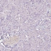 Anti-KCNH1 antibody produced in rabbit Prestige Antibodies&#174; Powered by Atlas Antibodies, affinity isolated antibody, buffered aqueous glycerol solution