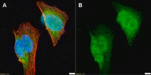 Anti-Cdk5 Antibody, clone 1H13 ZooMAb&#174; Rabbit Monoclonal recombinant, expressed in HEK 293 cells