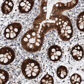 Anti-MAP2K6 antibody produced in rabbit Prestige Antibodies&#174; Powered by Atlas Antibodies, affinity isolated antibody, buffered aqueous glycerol solution