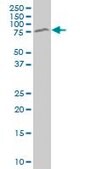 Monoclonal Anti-MECP2 antibody produced in mouse clone 1B11, purified immunoglobulin, buffered aqueous solution