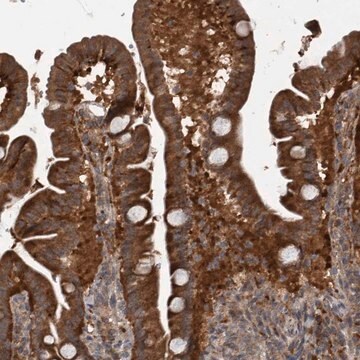 Anti-RABGGTB antibody produced in rabbit Prestige Antibodies&#174; Powered by Atlas Antibodies, affinity isolated antibody, buffered aqueous glycerol solution, Ab1