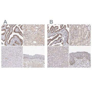 Anti-WRAP53 antibody produced in rabbit Prestige Antibodies&#174; Powered by Atlas Antibodies, affinity isolated antibody, buffered aqueous glycerol solution