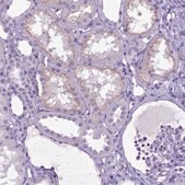 Anti-IGF2 antibody produced in rabbit Prestige Antibodies&#174; Powered by Atlas Antibodies, affinity isolated antibody, buffered aqueous glycerol solution