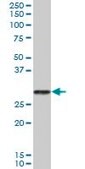 Anti-PRSS2 antibody produced in mouse IgG fraction of antiserum, buffered aqueous solution