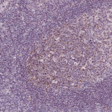 Anti-IL17C antibody produced in rabbit Prestige Antibodies&#174; Powered by Atlas Antibodies, affinity isolated antibody, buffered aqueous glycerol solution