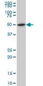 Monoclonal Anti-NR1H2 antibody produced in mouse clone 1E1, purified immunoglobulin, buffered aqueous solution