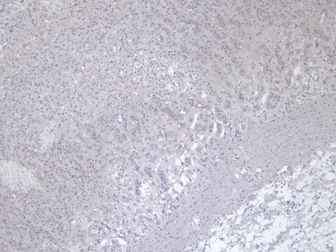 Anti-VMAT2/SLC18A2 antibody produced in goat affinity isolated antibody, buffered aqueous solution