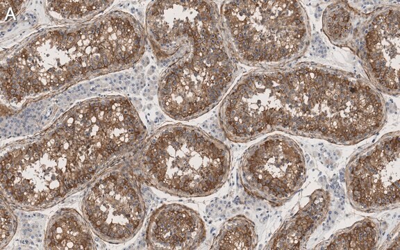 Anti-Nectin-2/CD112 Antibody, clone 2H6 ZooMAb&#174; Rabbit Monoclonal recombinant, expressed in HEK 293 cells