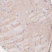 Anti-POLD3 antibody produced in rabbit Prestige Antibodies&#174; Powered by Atlas Antibodies, affinity isolated antibody, buffered aqueous glycerol solution