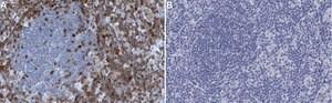 Anti-STAT5B Antibody, clone 2G13 ZooMAb&#174; Rabbit Monoclonal recombinant, expressed in HEK 293 cells
