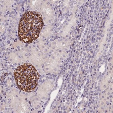 Anti-KLHL35 antibody produced in rabbit Prestige Antibodies&#174; Powered by Atlas Antibodies, affinity isolated antibody, buffered aqueous glycerol solution