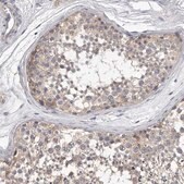 Anti-KLHL7 antibody produced in rabbit Prestige Antibodies&#174; Powered by Atlas Antibodies, affinity isolated antibody, buffered aqueous glycerol solution, ab1