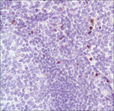 Anti-FOXP3 antibody, Rabbit monoclonal clone SP97, recombinant, expressed in proprietary host, affinity isolated antibody