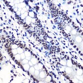 Anti-Phospho-I&#954;B&#945;-S36 antibody produced in rabbit