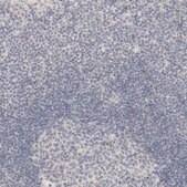 Anti-CA13 antibody produced in rabbit Prestige Antibodies&#174; Powered by Atlas Antibodies, affinity isolated antibody, buffered aqueous glycerol solution