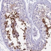 Anti-GAPDHS antibody produced in rabbit Prestige Antibodies&#174; Powered by Atlas Antibodies, affinity isolated antibody, buffered aqueous glycerol solution